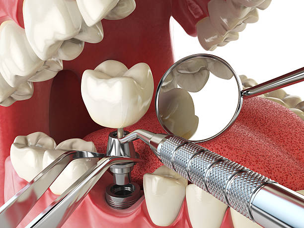 Dentist for Dental Trauma in MD